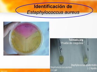 Identificación de
Estaphylococcus aureus
 