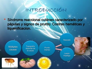 IINNTTRROODDUUCCCCIIÓÓNN 
 SSíínnddrroommee rreeaacccciioonnaall ccuuttáánneeoo ccaarraacctteerriizzaaddoo ppoorr 
ppááppuullaass yy ssiiggnnooss ddee pprruurriittoo:: CCoossttrraass hheemmááttiiccaass yy 
lliiqquueenniiffiiccaacciioonn.. 
MMúúllttiipplleess 
ccaauussaass 
TTooppooggrraaffííaa 
ddeeppeennddee ddee 
llaa ccaauussaa 
PPrruurriittoo 
IInntteennssoo 
RRaassccaaddoo 
LLeessiióónn 
IImmppééttiiggoo 
 