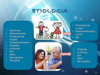 EETTIIOOLLOOGGIIAA 
• AAlliimmeennttooss 
• MMeeddiiccaammeennttooss 
• PPiiccaadduurraass ddee 
iinncceessttoo 
• PPoosstteexxeenntteemmaattiiccoo 
• DDiiaabbeetteess 
• LLiinnffoommaass 
• SSooll 
• SSeenniill 
• NNeeuurrooppaattiiccoo 
• PPaarráássiittooss 
• PPiiccaadduurraass ddee 
iinncceessttoo 
• PPoosstteexxeenntteemmaattiiccoo 
((vviirruuss)) 
• SSooll 
• DDiiaabbeetteess 
• LLiinnffoommaass 
• SSooll 
• SSeenniill 
• NNeeuurrooppaattiiccoo 
 