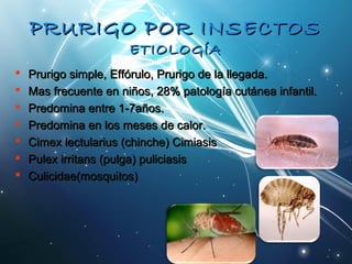 PPRRUURRIIGGOO PPOORR IINNSSEECCTTOOSS 
EETTIIOOLLOOGGÍÍAA 
 PPrruurriiggoo ssiimmppllee,, EEffffóórruulloo,, PPrruurriiggoo ddee llaa lllleeggaaddaa.. 
 MMaass ffrreeccuueennttee eenn nniiññooss,, 2288%% ppaattoollooggííaa ccuuttáánneeaa iinnffaannttiill.. 
 PPrreeddoommiinnaa eennttrree 11--77aaññooss.. 
 PPrreeddoommiinnaa eenn llooss mmeesseess ddee ccaalloorr.. 
 CCiimmeexx lleeccttuullaarriiuuss ((cchhiinncchhee)) CCiimmiiaassiiss 
 PPuulleexx iirrrriittaannss ((ppuullggaa)) ppuulliicciiaassiiss 
 CCuulliicciiddaaee((mmoossqquuiittooss)) 
 