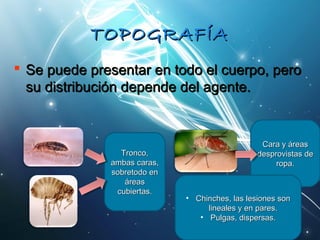 TTOOPPOOGGRRAAFFÍÍAA 
 SSee ppuueeddee pprreesseennttaarr eenn ttooddoo eell ccuueerrppoo,, ppeerroo 
ssuu ddiissttrriibbuucciióónn ddeeppeennddee ddeell aaggeennttee.. 
TTrroonnccoo,, 
aammbbaass ccaarraass,, 
ssoobbrreettooddoo eenn 
áárreeaass 
ccuubbiieerrttaass.. 
CCaarraa yy áárreeaass 
ddeesspprroovviissttaass ddee 
rrooppaa.. 
• CChhiinncchheess,, llaass lleessiioonneess ssoonn 
lliinneeaalleess yy eenn ppaarreess.. 
• PPuullggaass,, ddiissppeerrssaass.. 
 