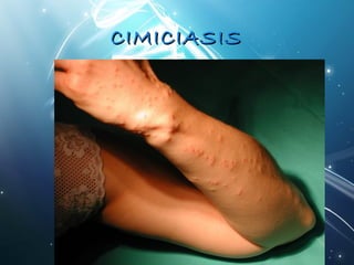 CCIIMMIICCIIAASSIISS 
 