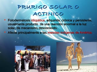 PPRRUURRIIGGOO SSOOLLAARR OO 
AACCTTIINNIICCOO 
 FFoottooddeerrmmaattoossiiss iiddiiooppááttiiccaa,, aaddqquuiirriiddaa,, ccrróónniiccaa yy ppeerrssiisstteennttee,, 
uussuuaallmmeennttee pprroodduuccttoo ddee uunnaa rreeaacccciióónn aannoorrmmaall aa llaa lluuzz 
ssoollaarr,, ddee mmeeccaanniissmmoo ddeessccoonnoocciiddoo.. 
 AAffeeccttaa pprriinncciippaallmmeennttee aa llaass mmeessccllaass iinnddííggeennaass ddee AAmméérriiccaa.. 
 