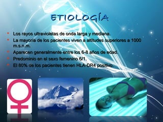 EETTIIOOLLOOGGÍÍAA 
 LLooss rraayyooss uullttrraavviioolleettaass ddee oonnddaa llaarrggaa yy mmeeddiiaannaa.. 
 LLaa mmaayyoorrííaa ddee llooss ppaacciieenntteess vviivveenn aa aallttiittuuddeess ssuuppeerriioorreess aa 11000000 
mm..ss..nn..mm.. 
 AAppaarreecceenn ggeenneerraallmmeennttee eennttrree llooss 66--88 aaññooss ddee eeddaadd.. 
 PPrreeddoommiinniioo eenn eell sseexxoo ffeemmeenniinnoo 66//11.. 
 EEll 8800%% ddee llooss ppaacciieenntteess ttiieenneenn HHLLAA--DDRR44 ppoossiittiivvoo.. 
 