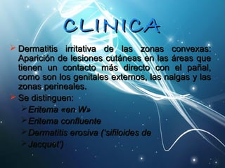 CCLLIINNIICCAA 
DDeerrmmaattiittiiss iirrrriittaattiivvaa ddee llaass zzoonnaass ccoonnvveexxaass:: 
AAppaarriicciióónn ddee lleessiioonneess ccuuttáánneeaass eenn llaass áárreeaass qquuee 
ttiieenneenn uunn ccoonnttaaccttoo mmááss ddiirreeccttoo ccoonn eell ppaaññaall,, 
ccoommoo ssoonn llooss ggeenniittaalleess eexxtteerrnnooss,, llaass nnaallggaass yy llaass 
zzoonnaass ppeerriinneeaalleess.. 
SSee ddiissttiinngguueenn:: 
EErriitteemmaa «eenn WW» 
EErriitteemmaa ccoonnfflluueennttee 
DDeerrmmaattiittiiss eerroossiivvaa ((‘‘ssiiffiillooiiddeess ddee 
JJaaccqquueett’’)) 
 