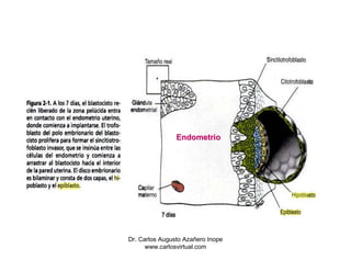 Endometrio




Dr. Carlos Augusto Azañero Inope
      www.carlosvirtual.com
 