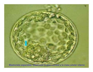 Dr. Carlos Augusto Azañero Inope
Blastocisto expandido. Obsérvese la gran cavidad y la masa celular interna
                           www.carlosvirtual.com
 