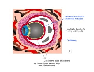 Membrana Exocelomica
                                   (membrana de Heuser)




                                     Trofoblasto




Dr. Carlos Augusto Azañero Inope
      www.carlosvirtual.com
 