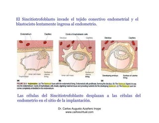 El Sincitiotrofoblasto invade el tejido conectivo endometrial y el
blastocisto lentamente ingresa al endometrio.




Las células del Sincitiotrofoblasto desplazan a las células del
endometrio en el sitio de la implantación.
                      Dr. Carlos Augusto Azañero Inope
                            www.carlosvirtual.com
 