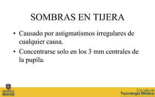 SOMBRAS EN TIJERA
• Causado por astigmatismos irregulares de
  cualquier causa.
• Concentrarse solo en los 3 mm centrales de
  la pupila.
 