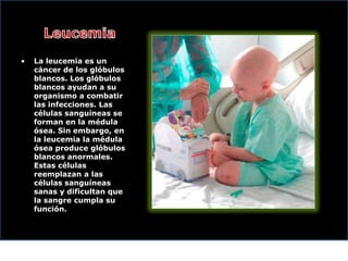 •

La leucemia es un
cáncer de los glóbulos
blancos. Los glóbulos
blancos ayudan a su
organismo a combatir
las infecciones. Las
células sanguíneas se
forman en la médula
ósea. Sin embargo, en
la leucemia la médula
ósea produce glóbulos
blancos anormales.
Estas células
reemplazan a las
células sanguíneas
sanas y dificultan que
la sangre cumpla su
función.

 
