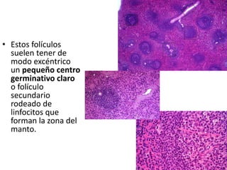 • Estos folículos
suelen tener de
modo excéntrico
un pequeño centro
germinativo claro
o folículo
secundario
rodeado de
linfocitos que
forman la zona del
manto.

 