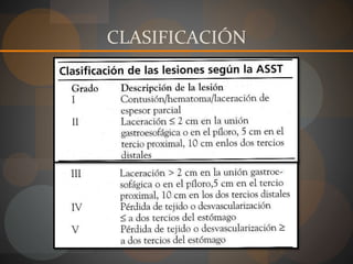 CLASIFICACIÓN
 