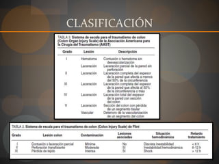 CLASIFICACIÓN
 
