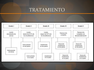 TRATAMIENTO
 