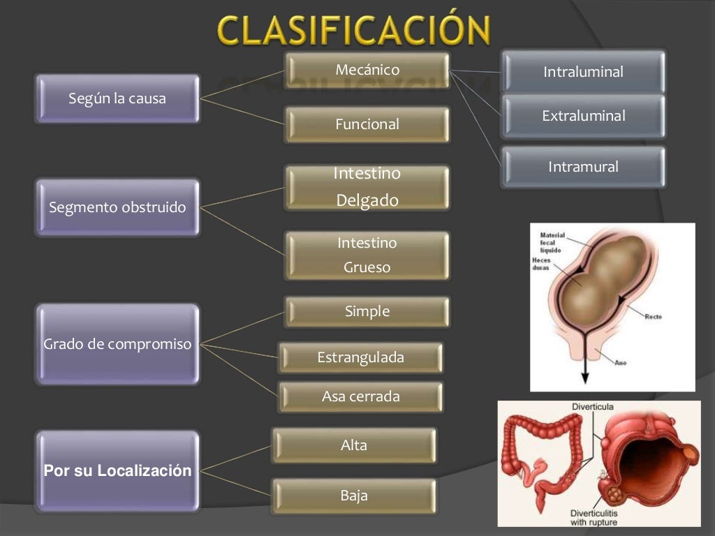 Clase abdomen agudo obstructivo