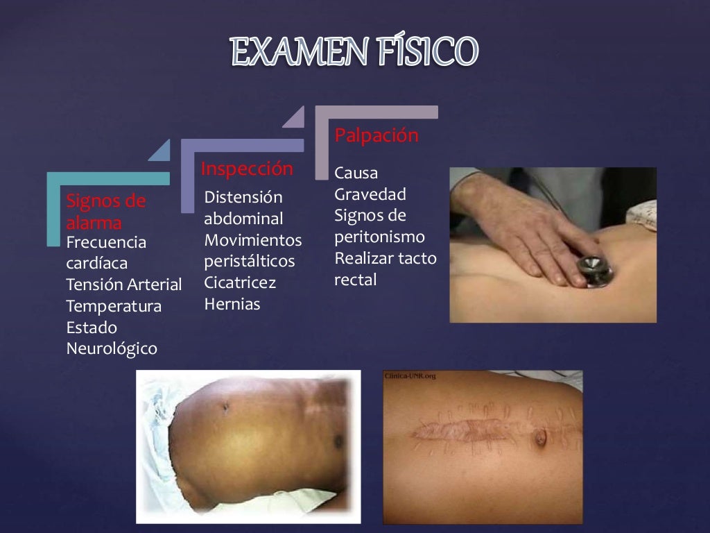 Clase abdomen agudo obstructivo