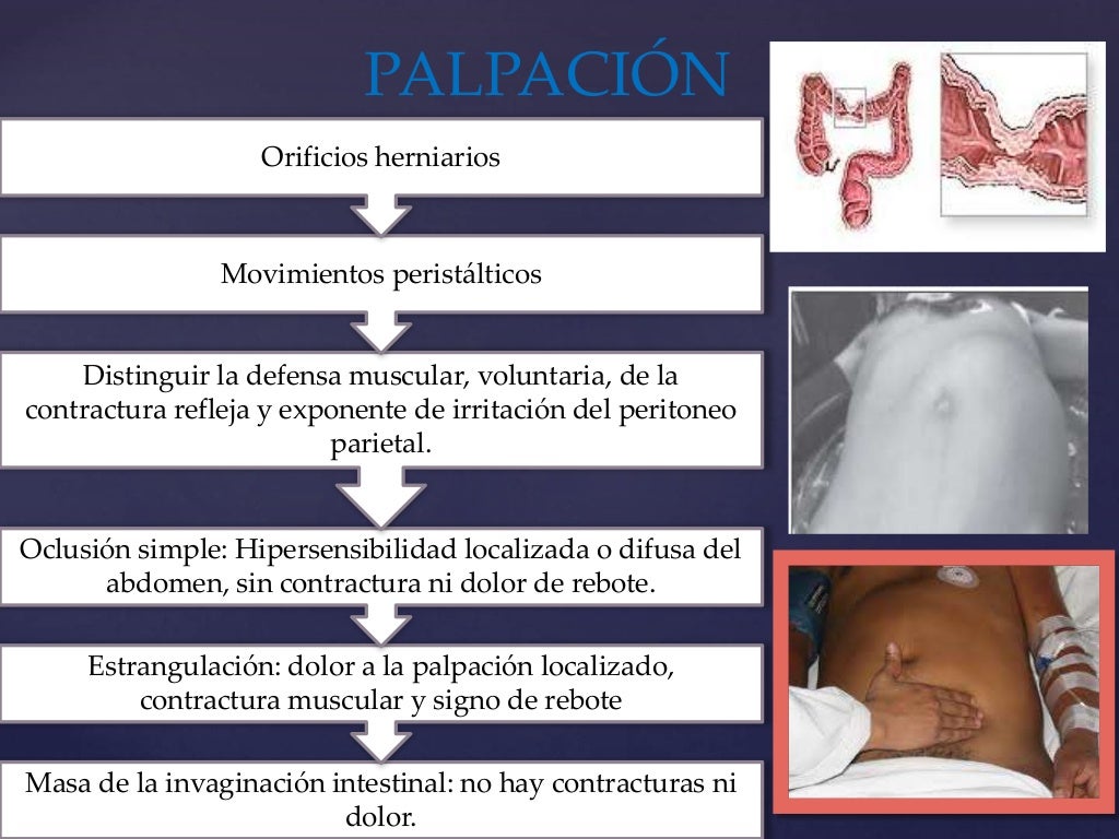 Clase abdomen agudo obstructivo