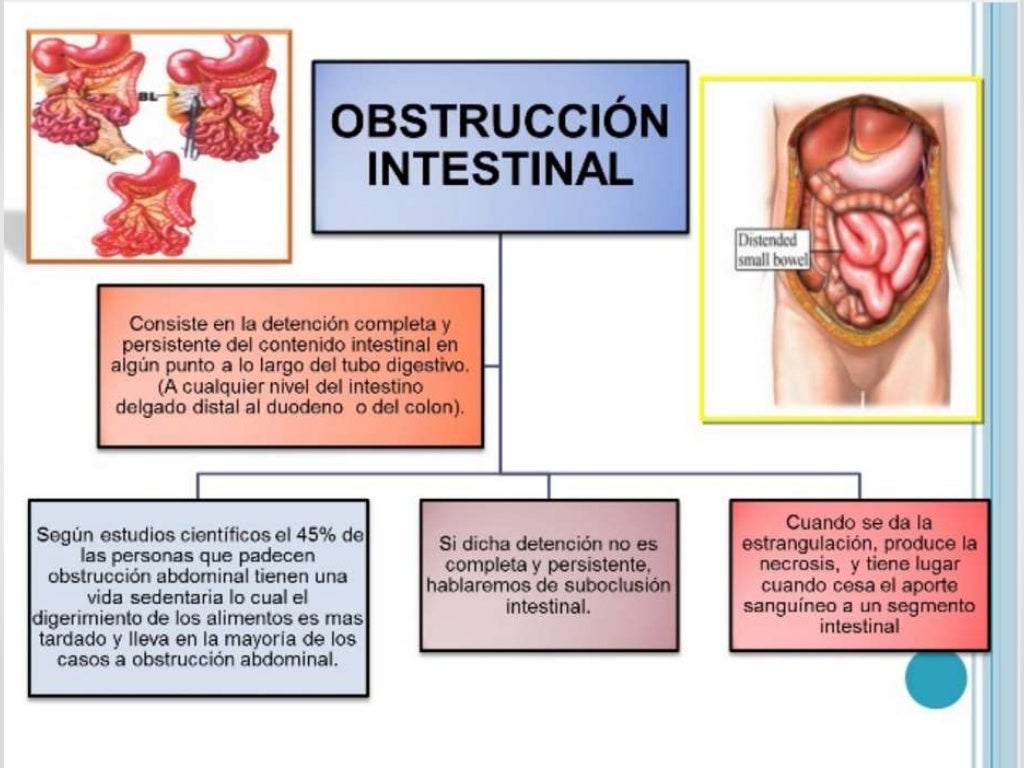 Clase abdomen agudo obstructivo