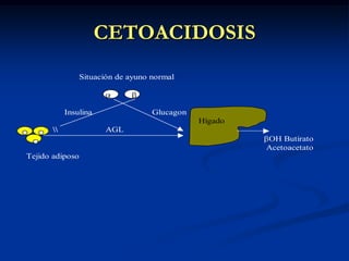 CETOACIDOSIS