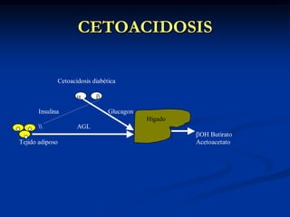 CETOACIDOSIS
