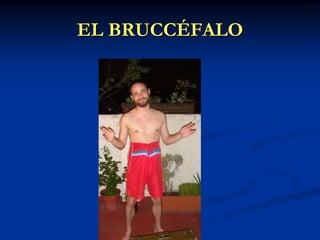 EL BRUCCÉFALO