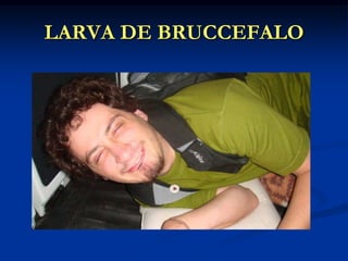 LARVA DE BRUCCEFALO