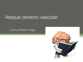 Ataque cerebro vascular
Yunny Chávez Vega
 