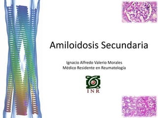 Amiloidosis Secundaria
Ignacio Alfredo Valerio Morales
Médico Residente en Reumatología
 