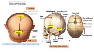 1-2 meses
Cierre de fontanelas
9-18 meses
Inmediato al nacimiento
BREGMA
LAMBA
ASTERION
PTERION
 