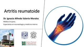 Artritis reumatoide
Dr. Ignacio Alfredo Valerio Morales
Médico Cirujano.
Especialista en reumatología y medicina interna.
 