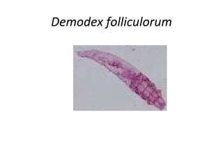 Demodex folliculorum
 