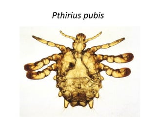 Pthirius pubis
 