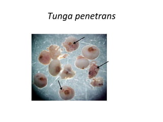 Tunga penetrans
 