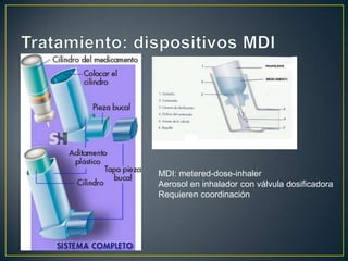MDI: metered-dose-inhaler
Aerosol en inhalador con válvula dosificadora
Requieren coordinación
 