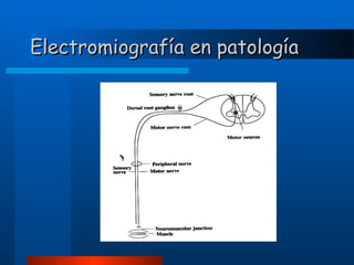Electromiografía en patología

 
