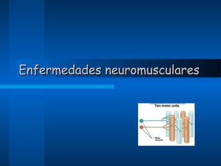 Enfermedades neuromusculares

 