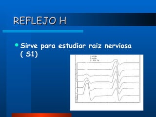 REFLEJO H
 Sirve

( S1)

para estudiar raiz nerviosa

 