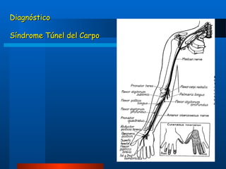 Diagnóstico
Síndrome Túnel del Carpo

 