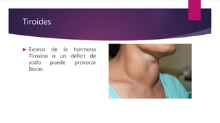 Tiroides
 Exceso de la hormona
Tiroxina o un déficit de
yodo puede provocar
Bocio.
 