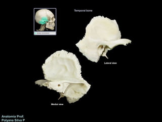 Anatomía Prof: 
Polyana Silva P 
Hueso Temporal 
 