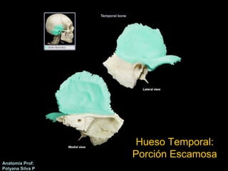Anatomía Prof: 
Polyana Silva P 
Hueso Temporal: 
Porción Escamosa 
 