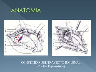 ANATOMIACONTENIDO DEL TRAYECTO INGUINAL (Cordón Espermático)