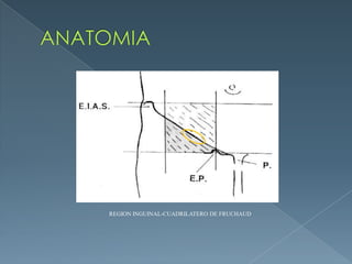ANATOMIAREGION INGUINAL-CUADRILATERO DE FRUCHAUD