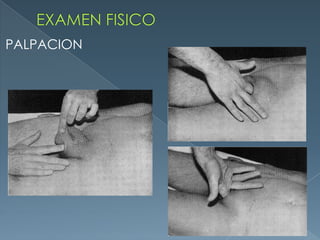 EXAMEN FISICOPALPACION