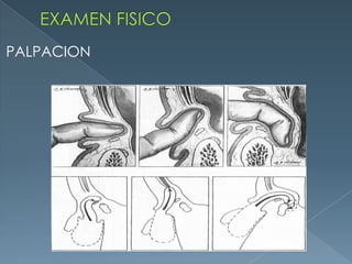 EXAMEN FISICOPALPACION