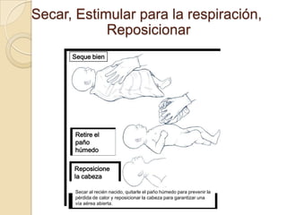 Secar, Estimular para la respiración,
            Reposicionar
      Seque bien




       Retire el
       paño
       húmedo

      Reposicione
      la cabeza

       Secar al recién nacido, quitarle el paño húmedo para prevenir la
       pérdida de calor y reposicionar la cabeza para garantizar una
       vía aérea abierta.
 