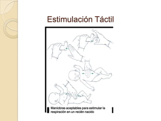 Estimulación Táctil




 Maniobras aceptables para estimular la
 respiración en un recién nacido
 
