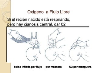 Oxígeno a Flujo Libre
Si el recién nacido está respirando,
pero hay cianosis central, dar 02




   bolsa inflada por flujo   por máscara   O2 por manguera
 