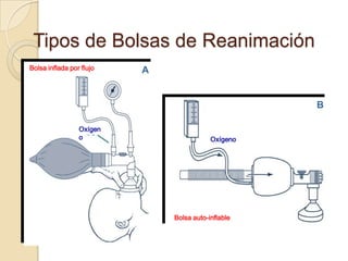 Tipos de Bolsas de Reanimación
Bolsa inflada por flujo   A


                                                    B

                 Oxígen
                 o                        Oxígeno




                              Bolsa auto-inflable
 